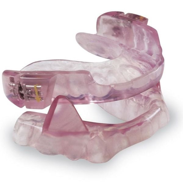 Custom oral appliance for sleep apnea treatment