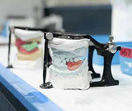 Dentures being crafted